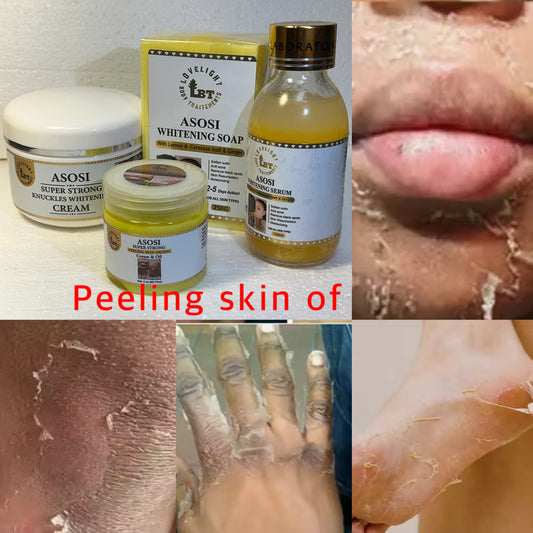 xx strong peeling skin of