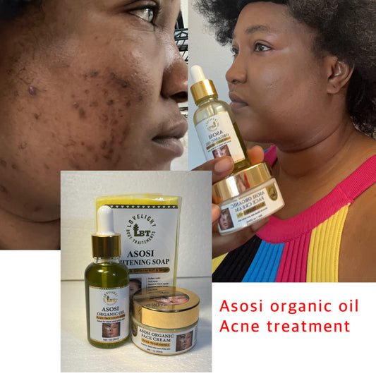 Asosi organic acne treatments 3pcs